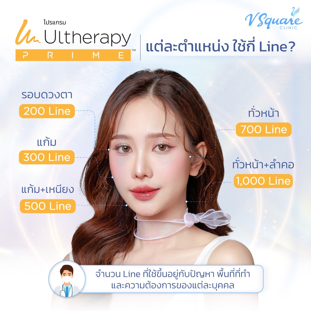 Ulthera แต่ละตำแหน่งใช้กี่ไลน์