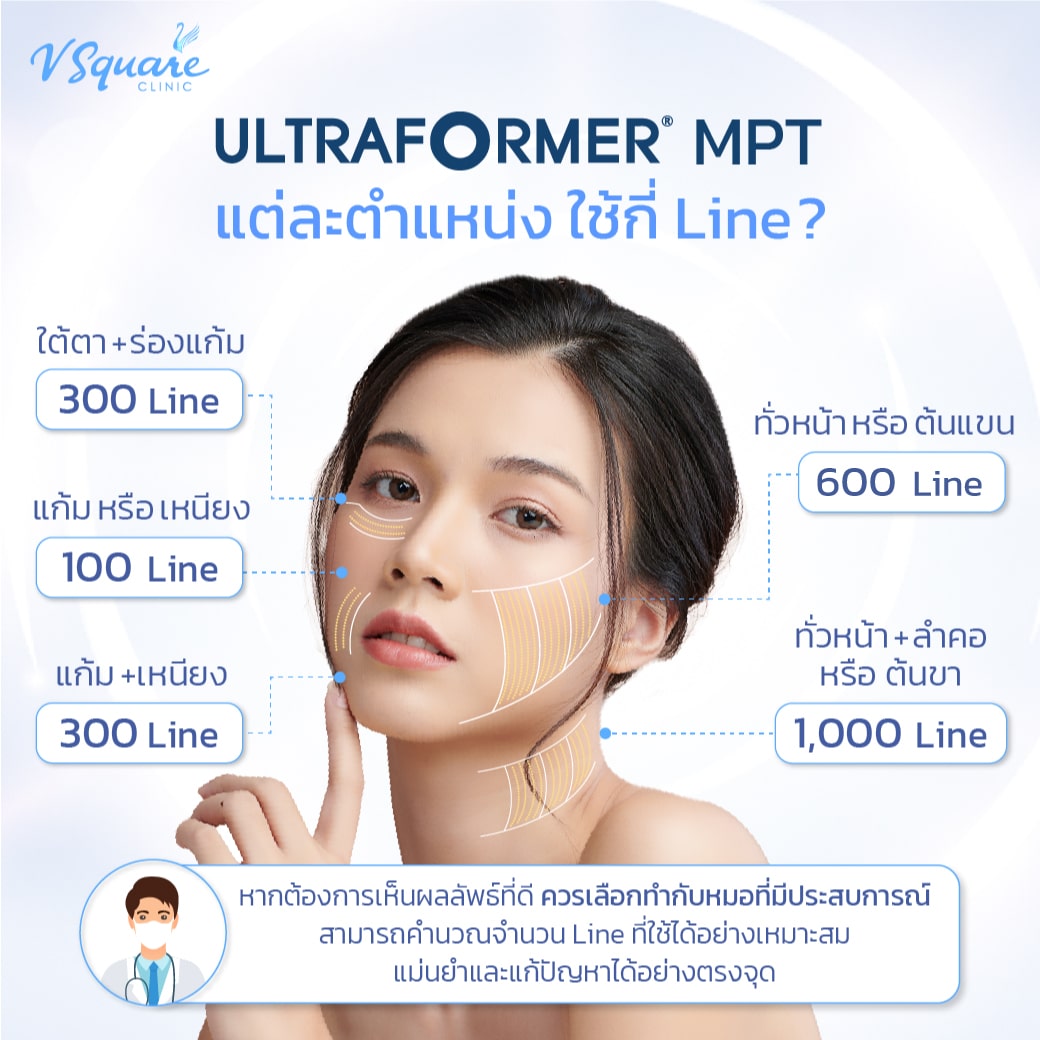 Ultraformer MPT ราคาแต่ละตำแหน่งใช้กี่ไลน์