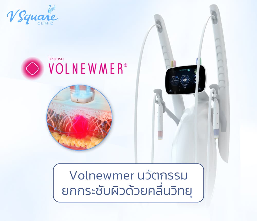 Volnewmer