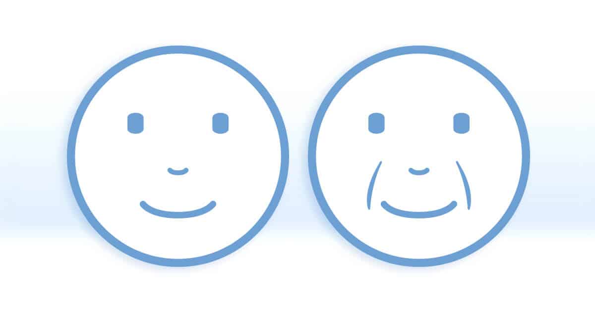 ฟิลเลอร์ร่องแก้ม ดีอย่างไร