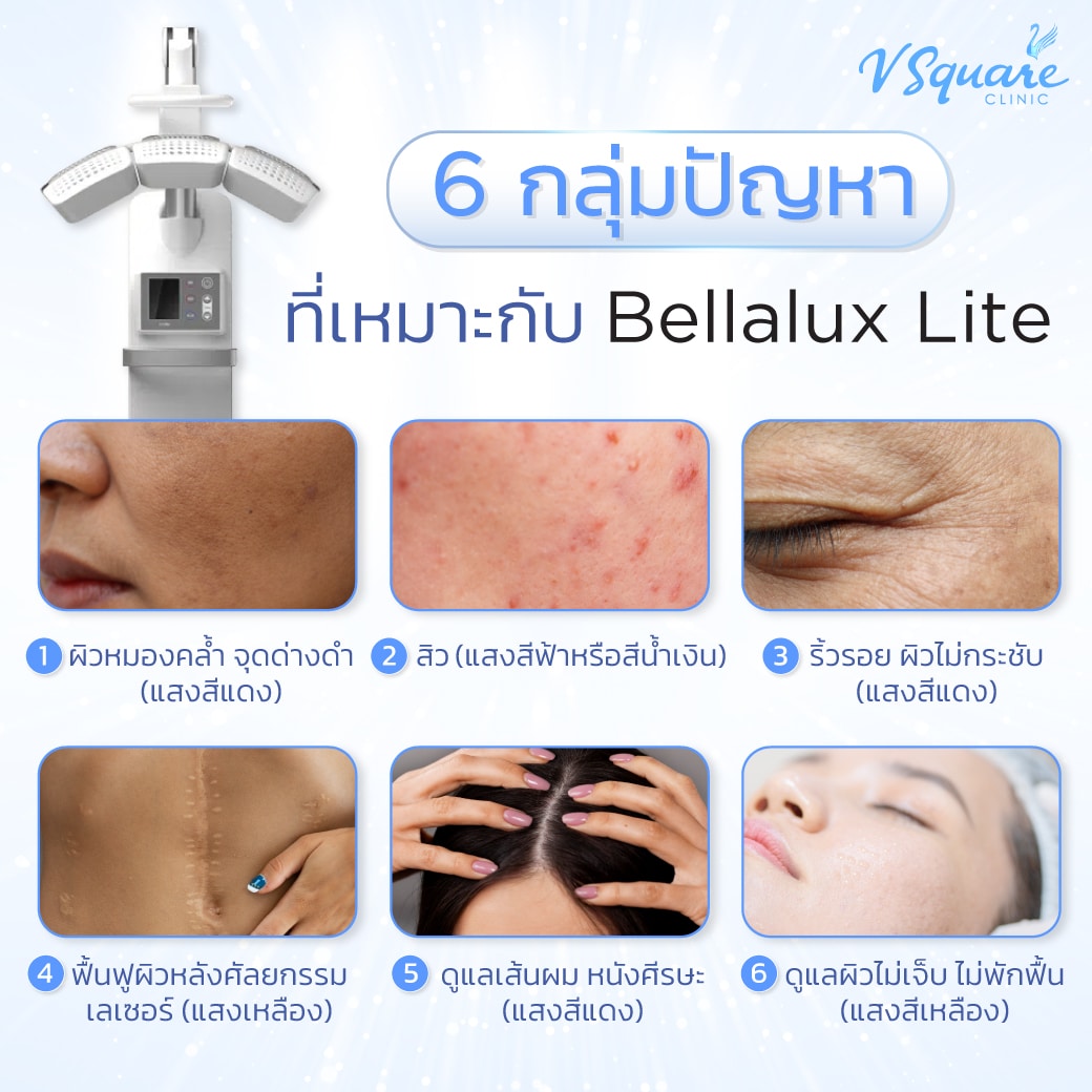 Bellalux Lite เหมาะกับใคร