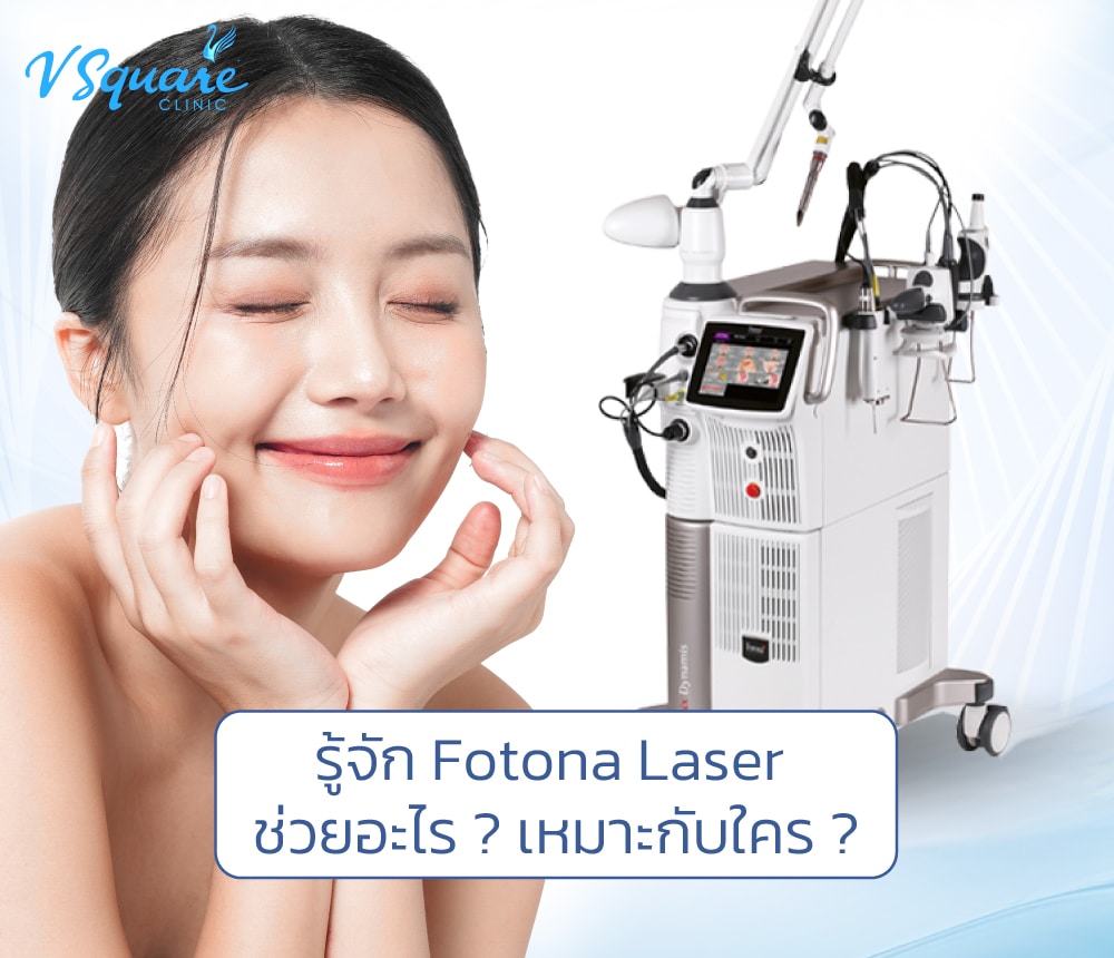 Fotona Laser