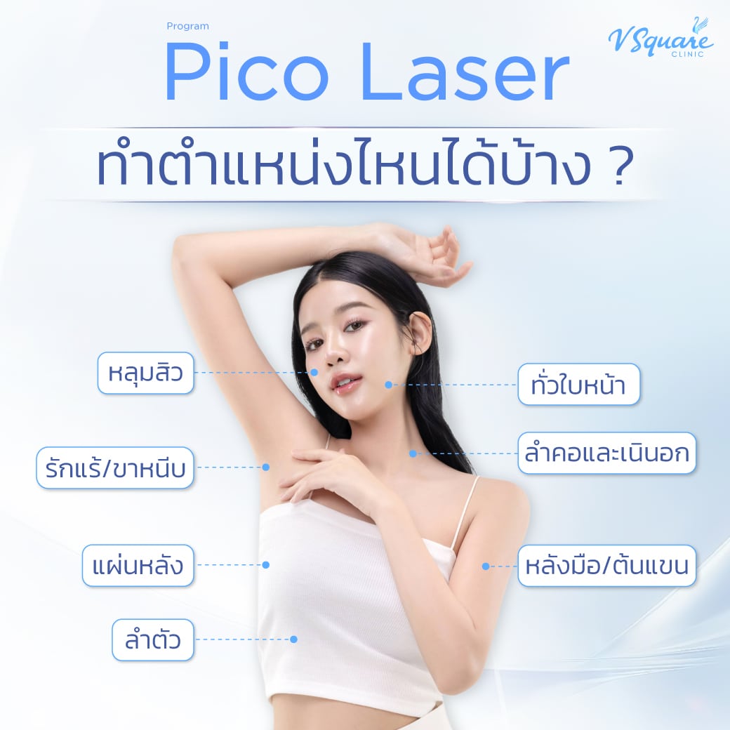Pico Laser ทำตำแหน่งไหนได้บ้าง