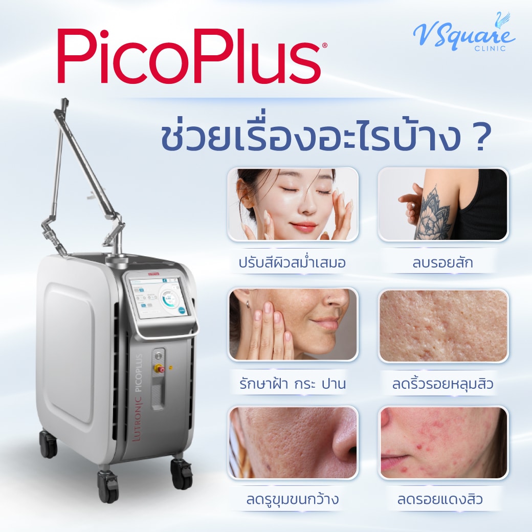 Pico Plus Machine Pico Plus คืออะไร ? รู้จักเทคโนโลยีเลเซอร์หน้าใส แก้ปัญหาผิวครบด้าน