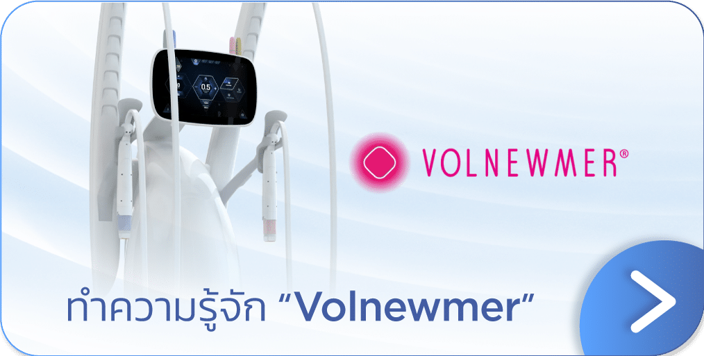 Volnewmer คือ