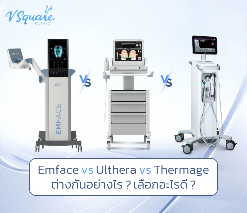 emface กับ ulthera และ thermage