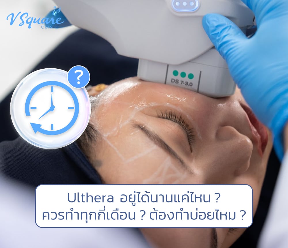 ulthera อยู่ได้นานแค่ไหน