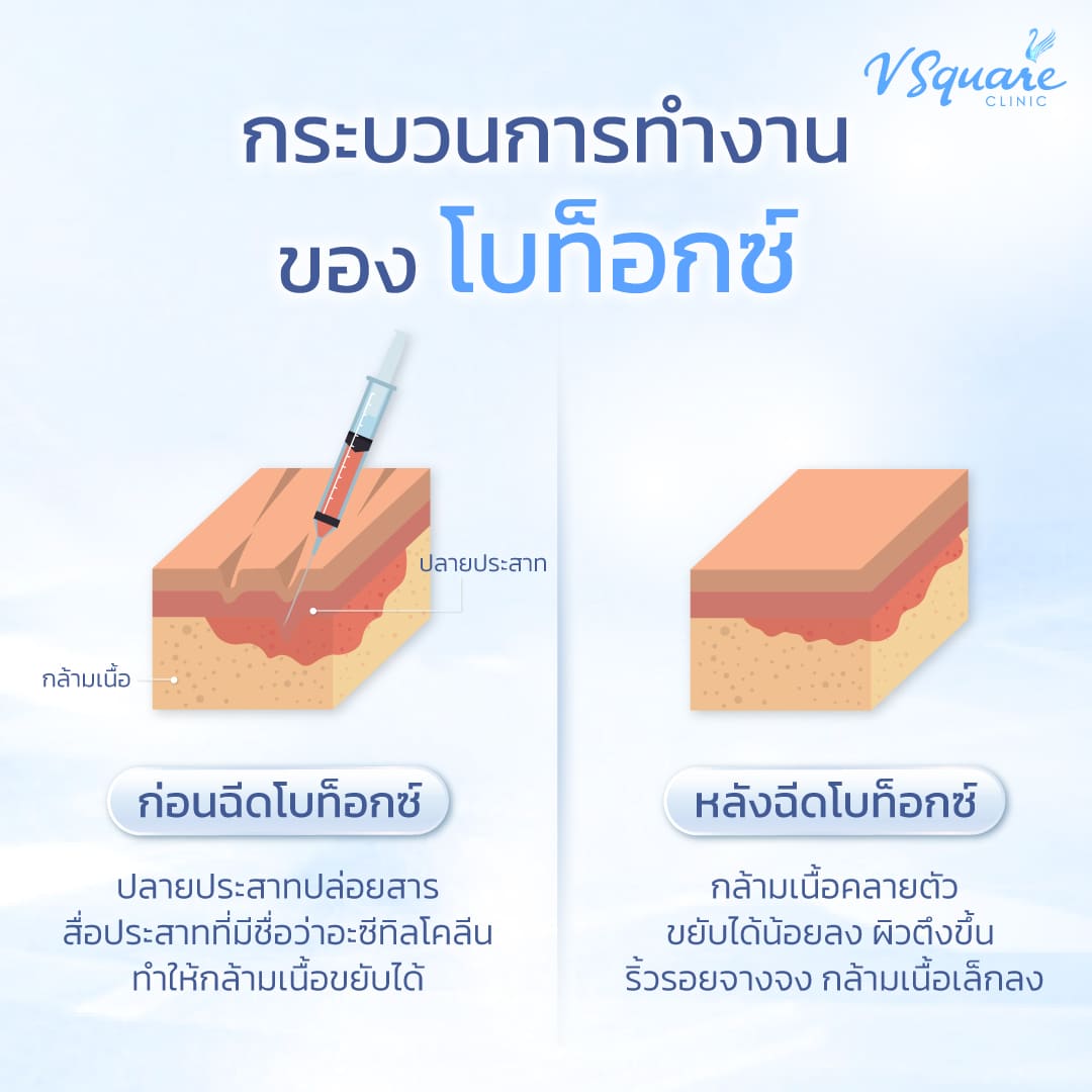 กระบวนการออกฤทธิ์ของโบท็อก