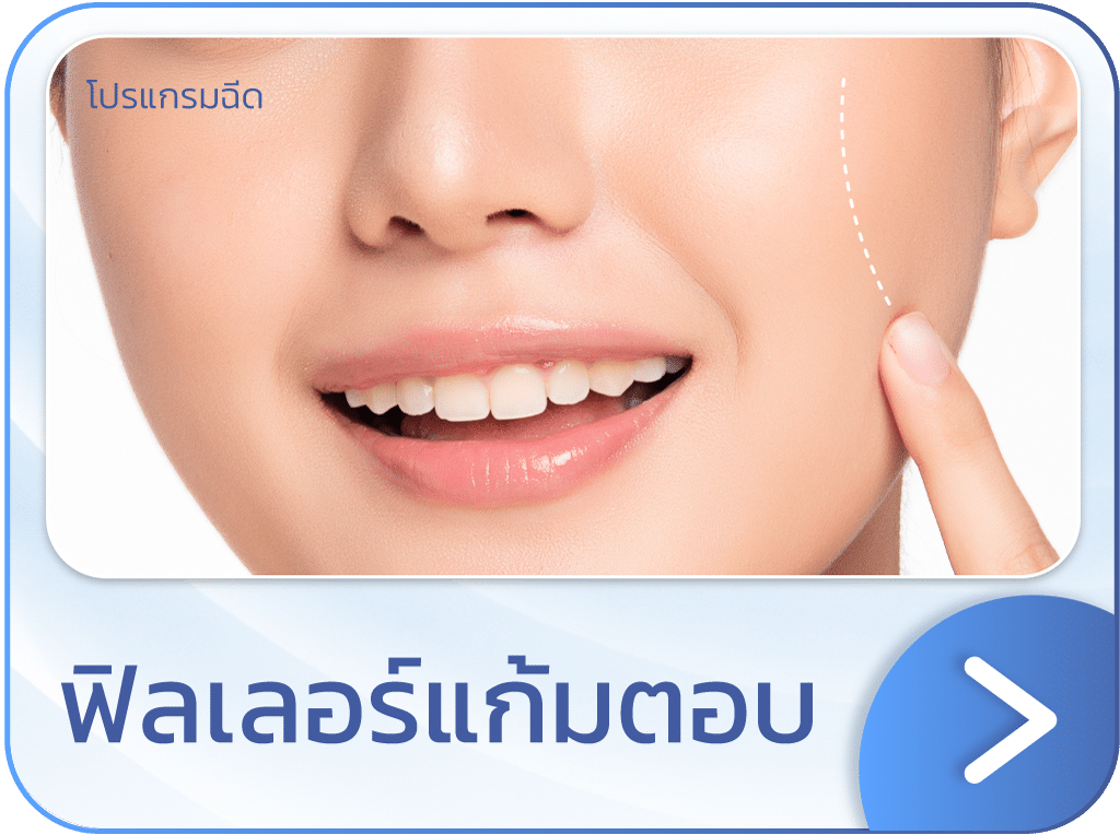 ฟิลเลอร์แก้มตอบ