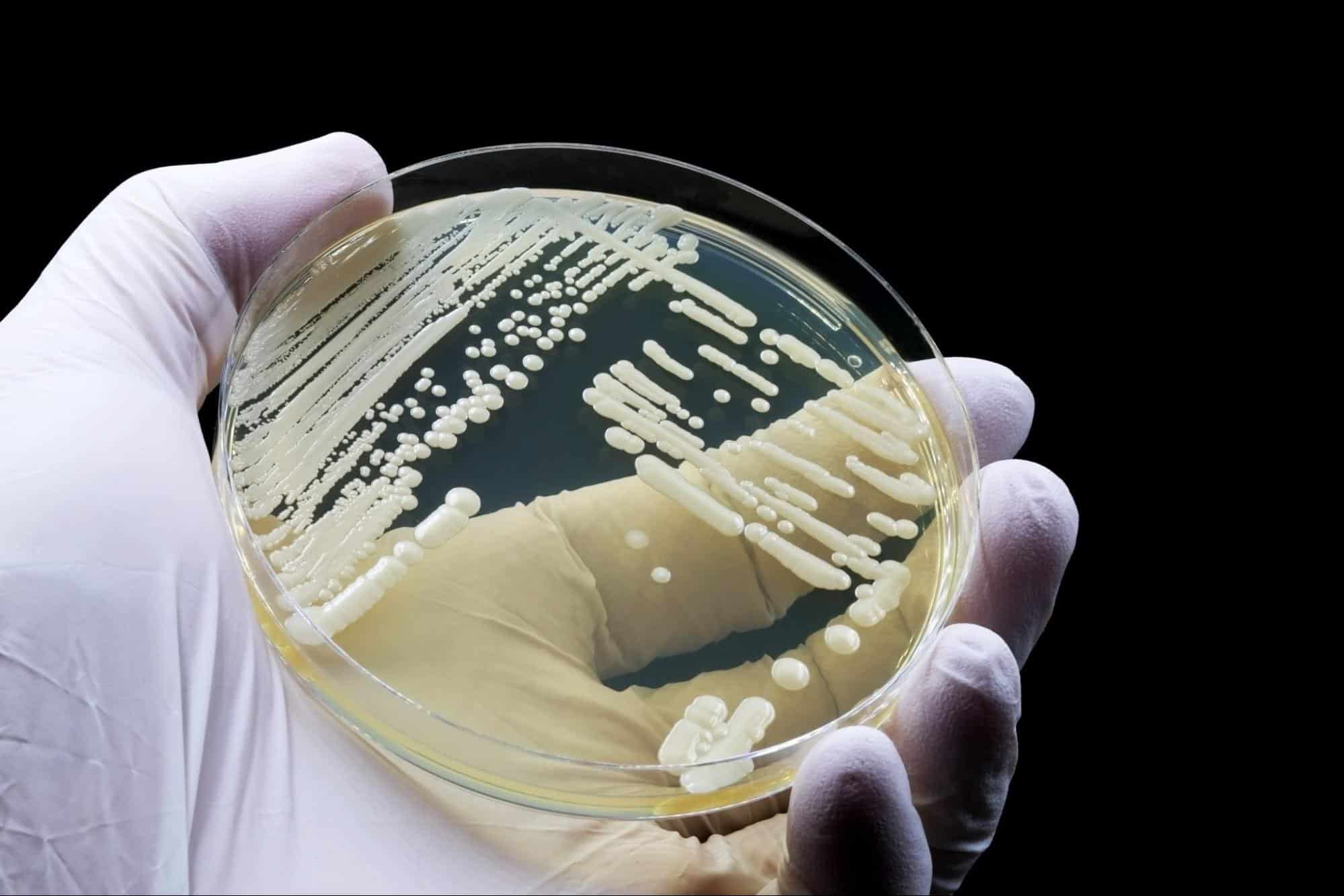 ภาวะติดเชื้อ Candida