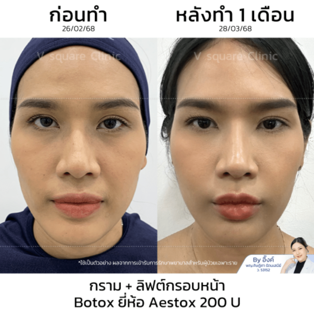 รีวิวโบท็อก_คุณกุญแจซอล