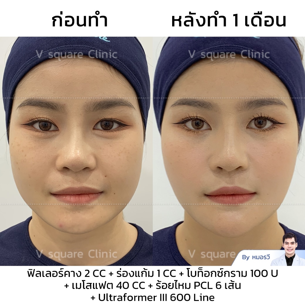 รีวิวโบท็อก_คุณหญิง