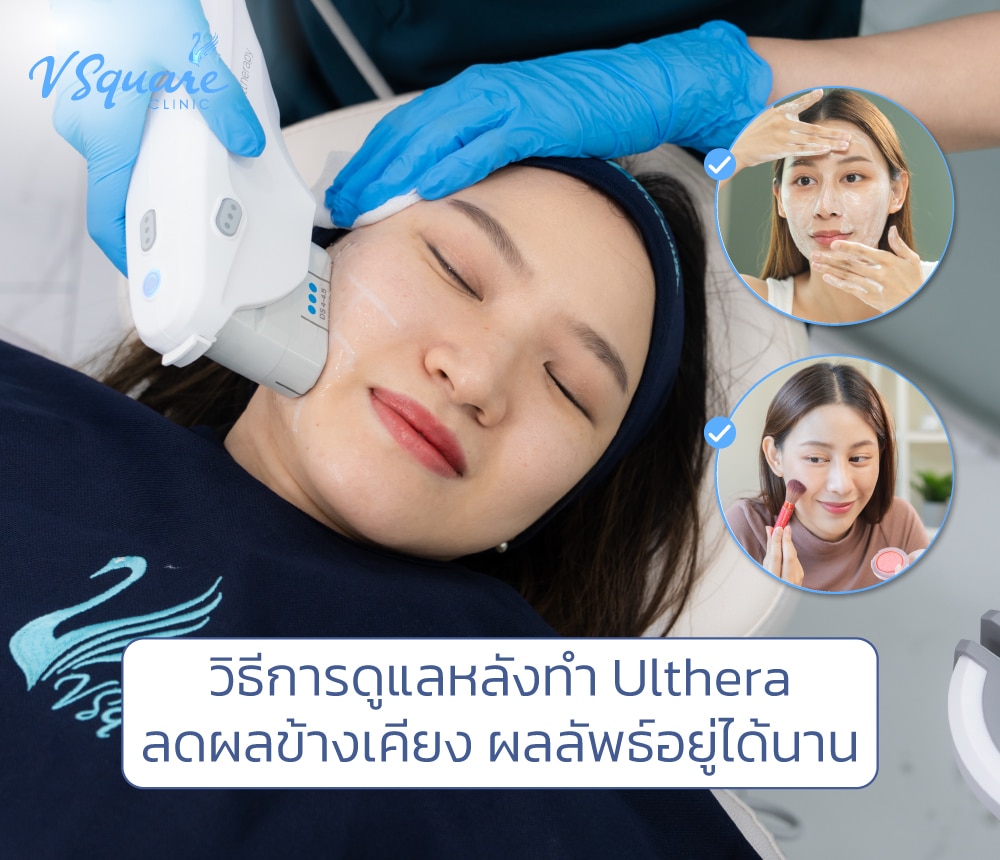 วิธีการดูแลหลังทำ Ulthera อัลเทอร่า
