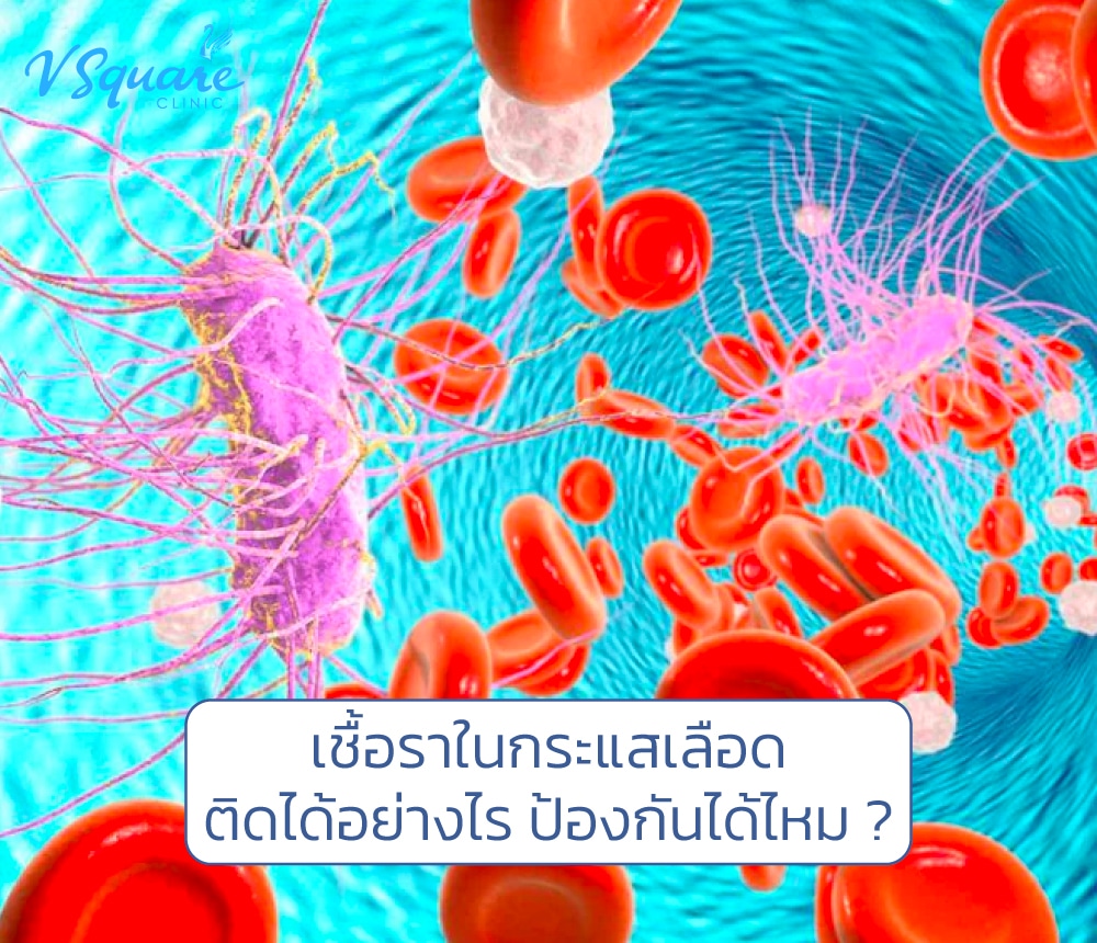 เชื้อราในกระแสเลือด