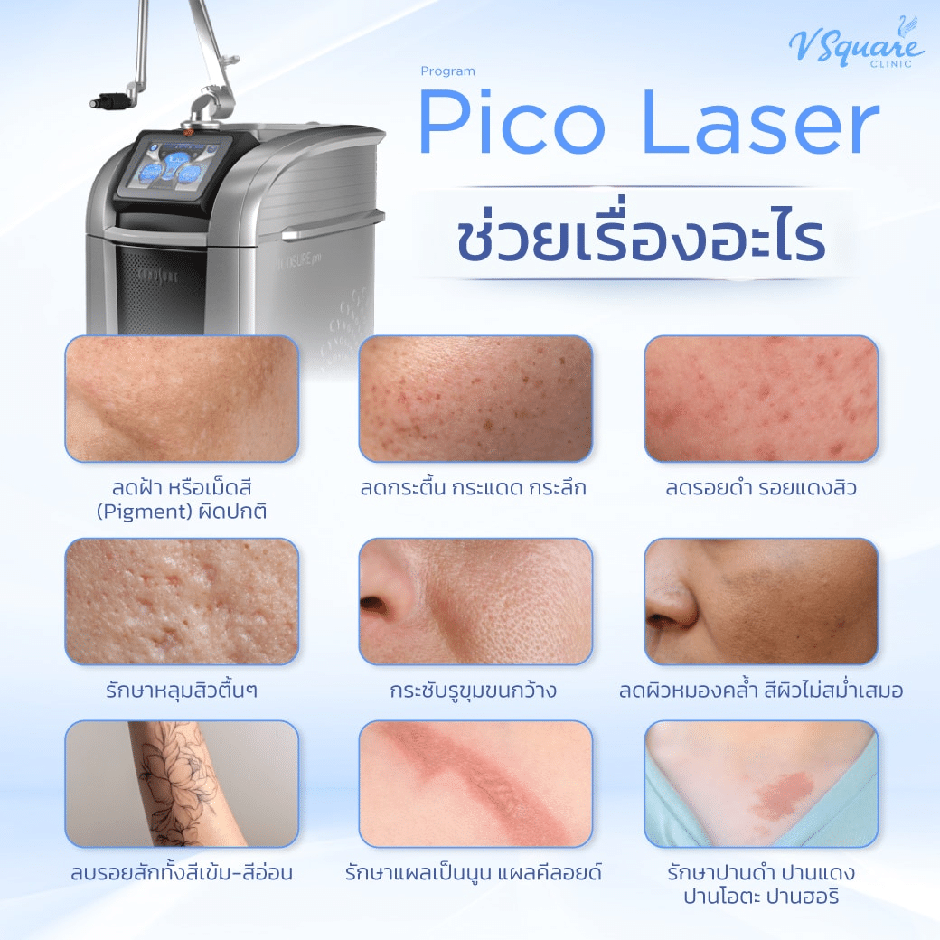 Pico Laser