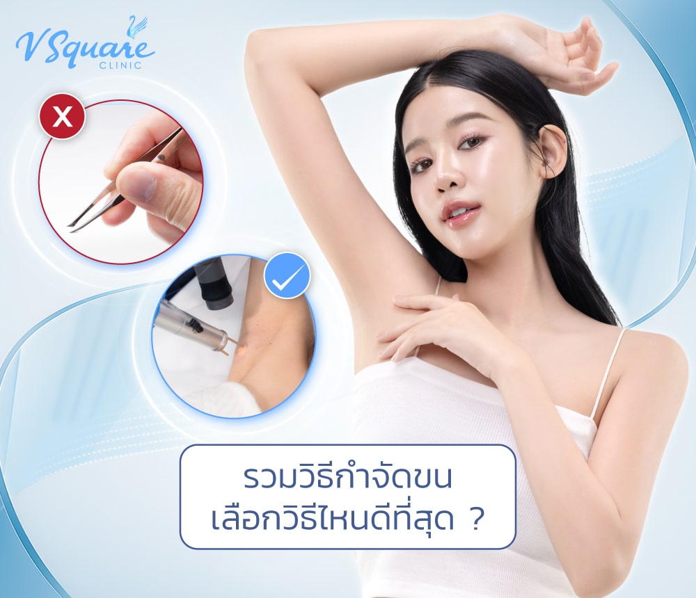 กำจัดขน