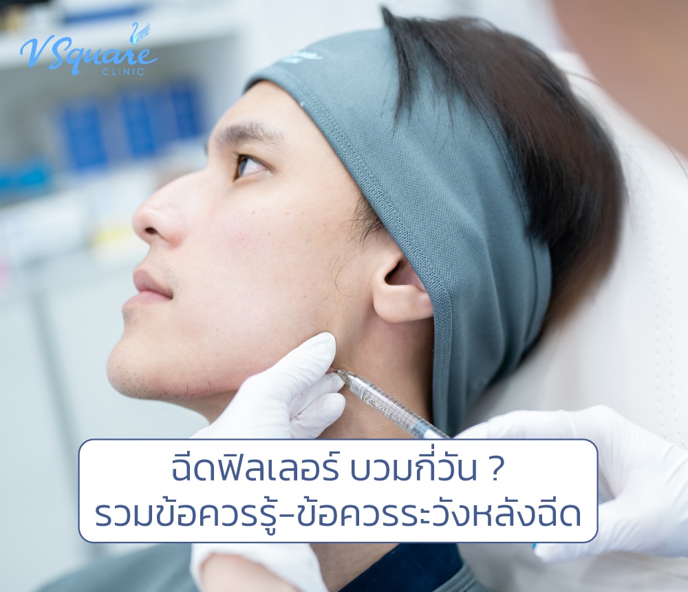 ฉีดฟิลเลอร์ บวมกี่วัน