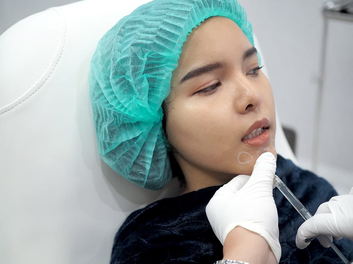 ฉีดฟิลเลอร์แล้วบวม