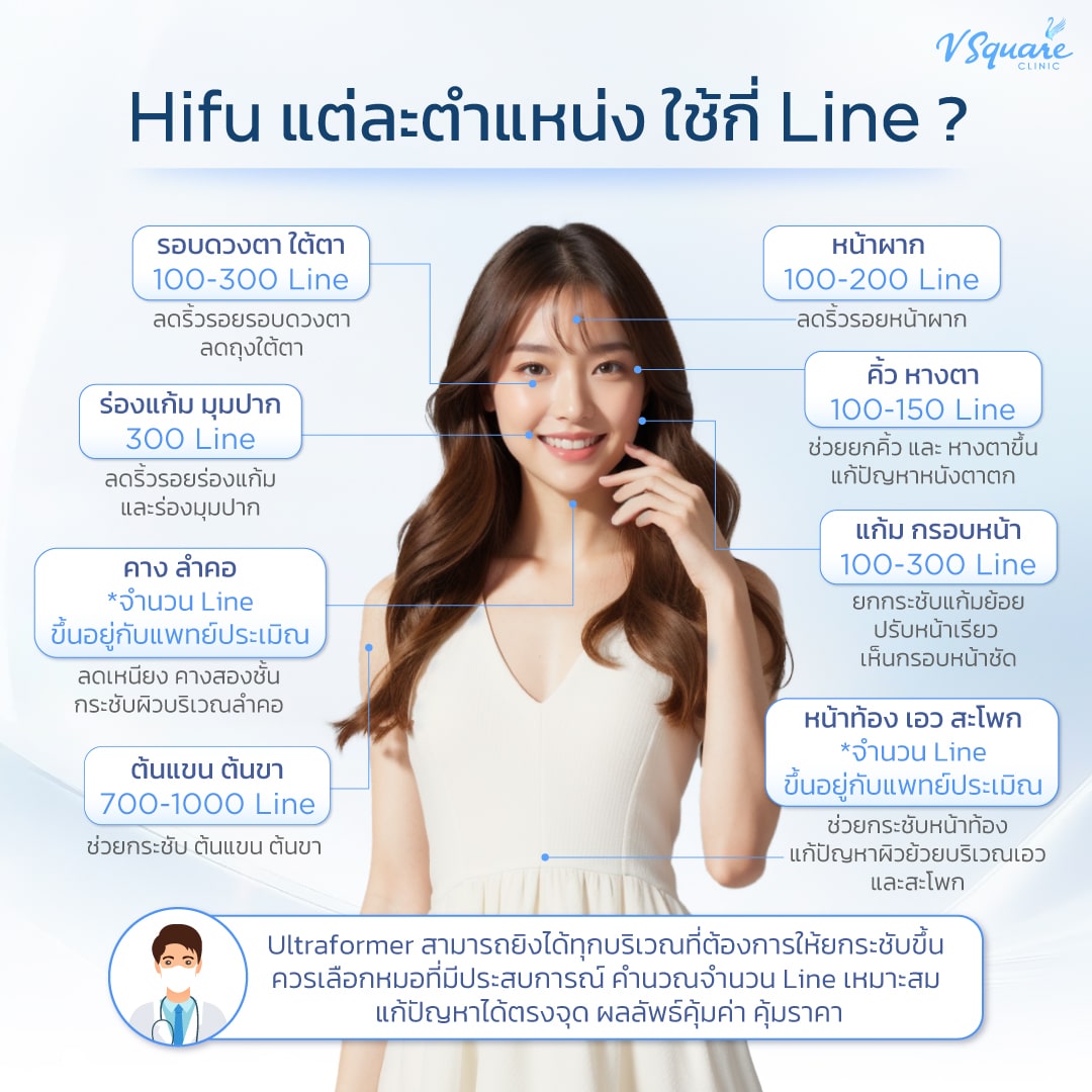 ทำ Hifu ราคา แต่ละจุดเท่าไหร่