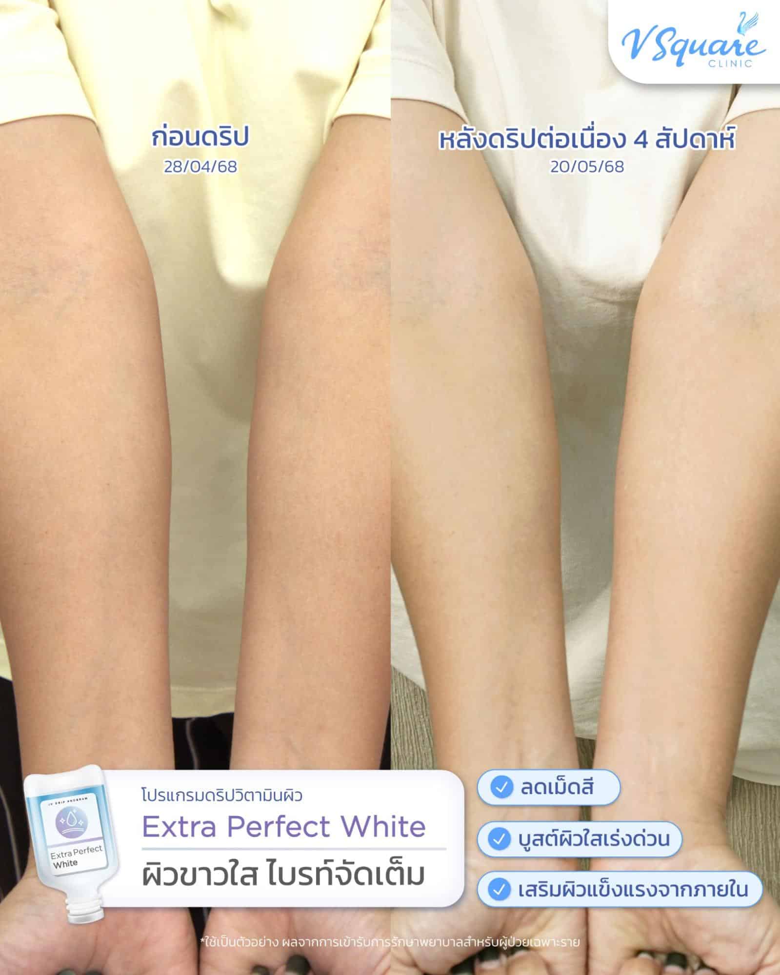 รีวิวดริปวิตามินผิวขาวใส