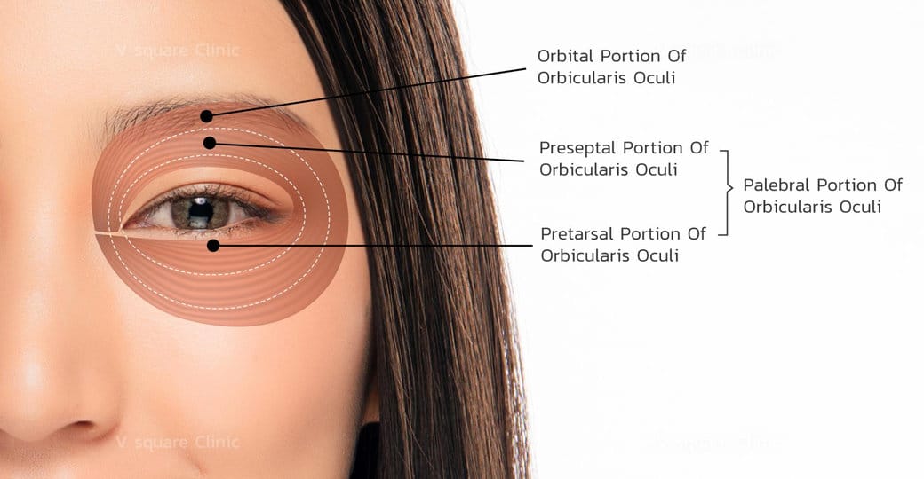 ลักษณะดอลลี่อาย