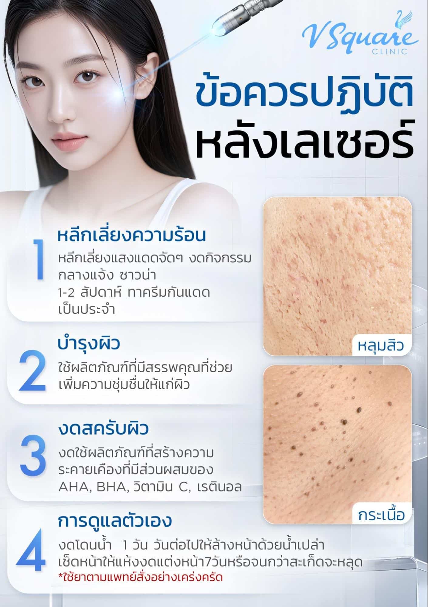วิธีดูแลหลังทำเลเซอร์หลุมสิว