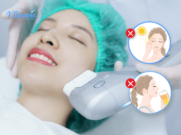 หลังทํา hifu ห้ามทําอะไรบ้าง _ 370x277