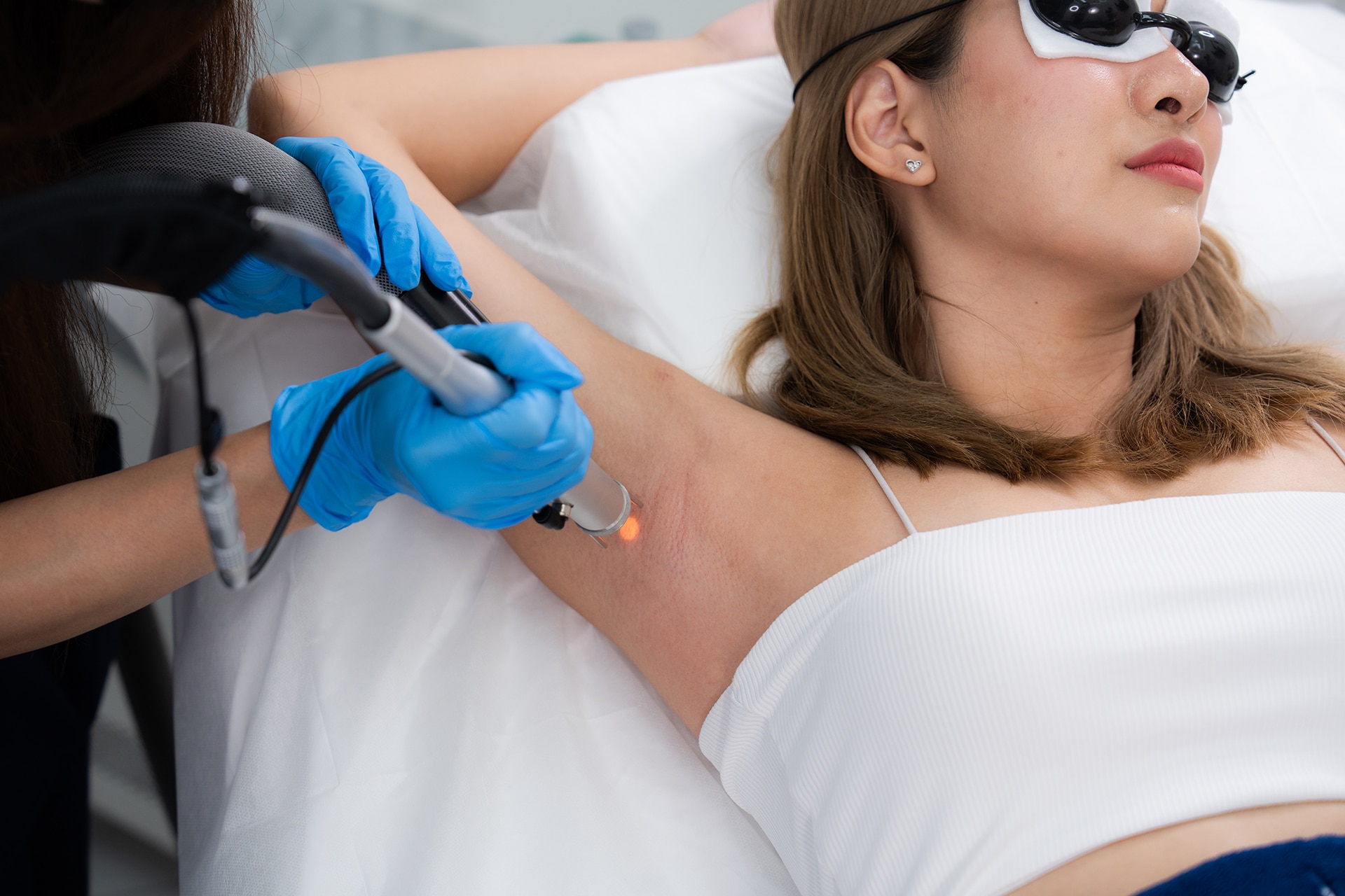 เลเซอร์กำจัดขนรักแร้กี่ครั้งเห็นผล