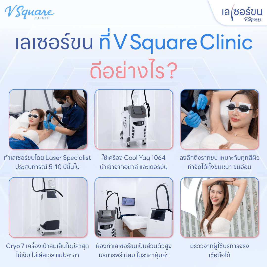 เลเซอร์ขนรักแร้ ที่ V Square Clinic