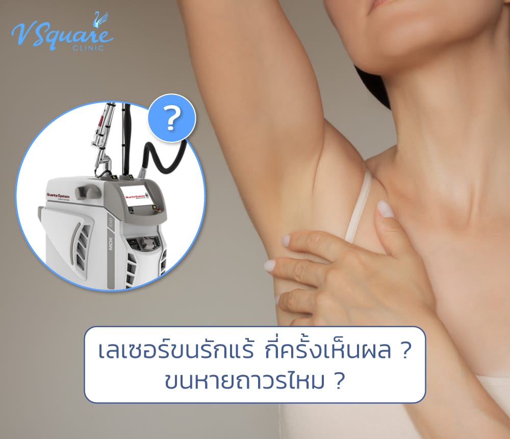 เลเซอร์ขนรักแร้กี่ครั้งเห็นผล