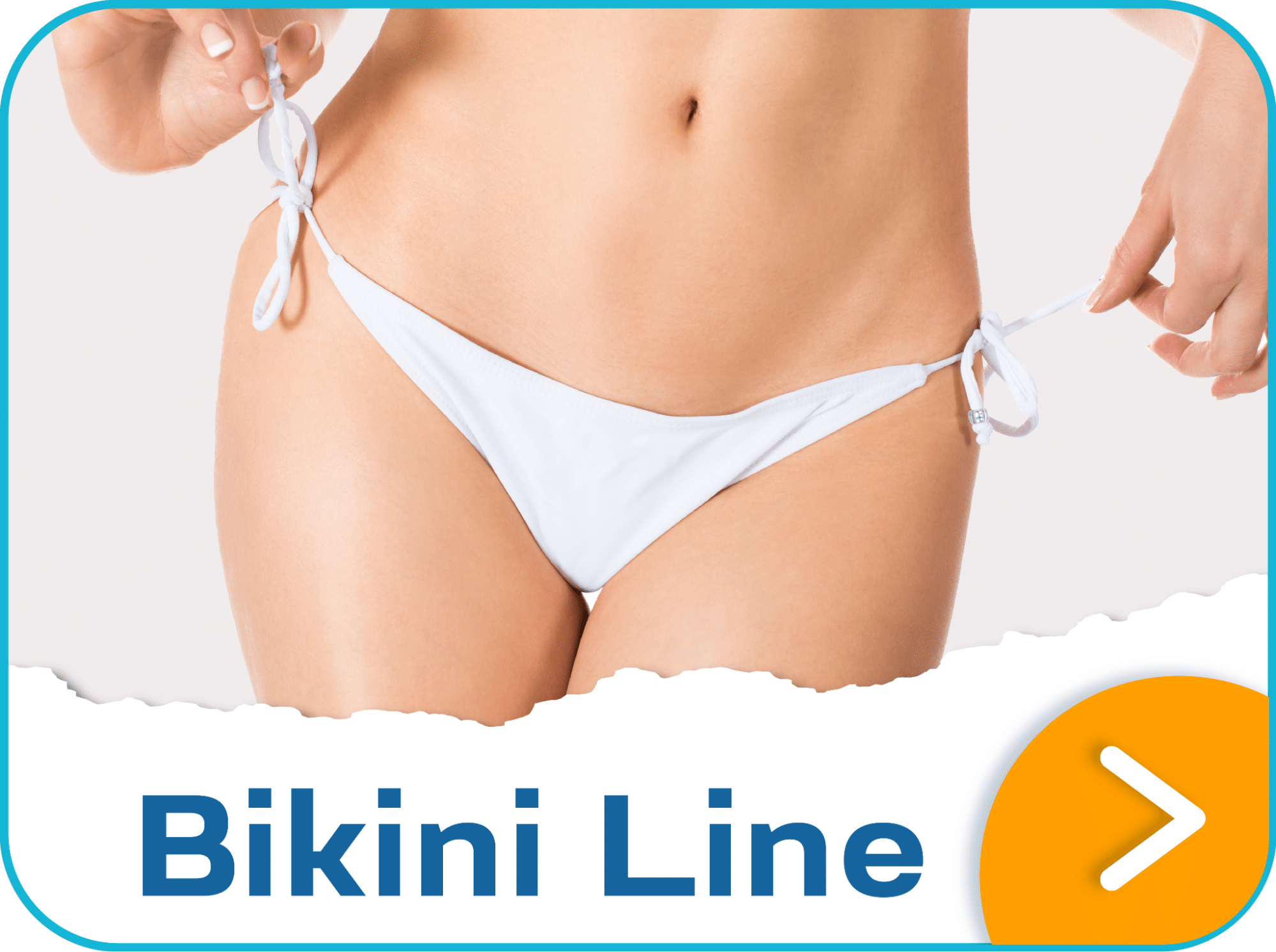 เลเซอร์บิกินี่