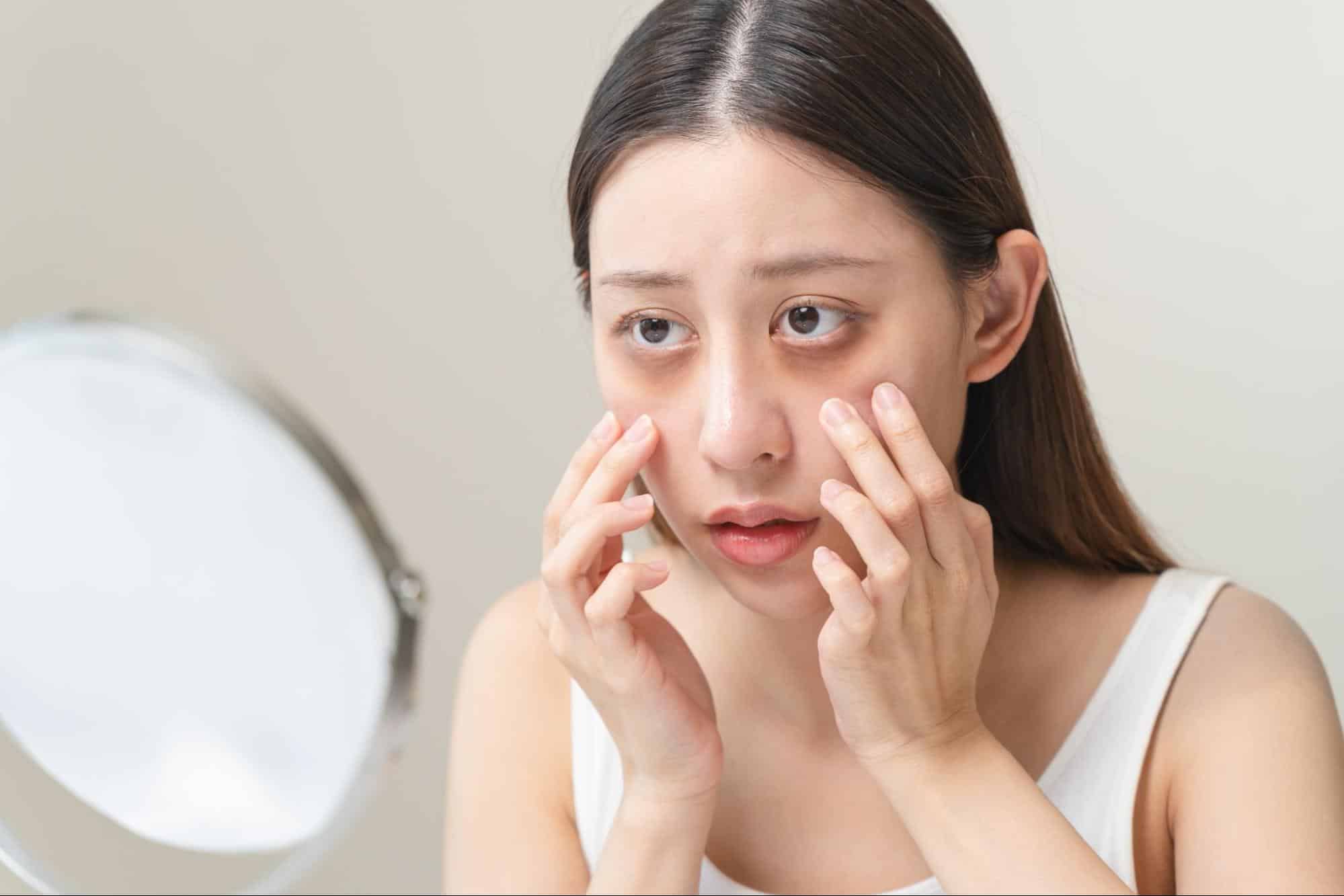 ขอบตาดำ คืออะไร