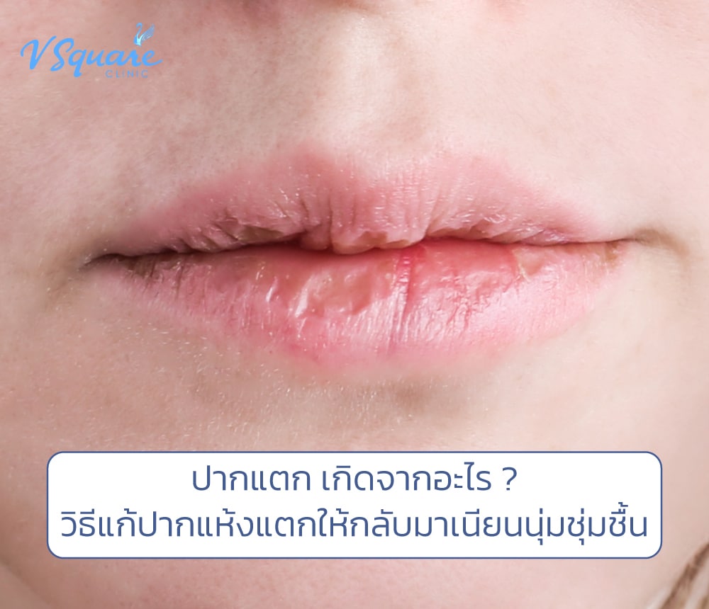 ปากแห้ง