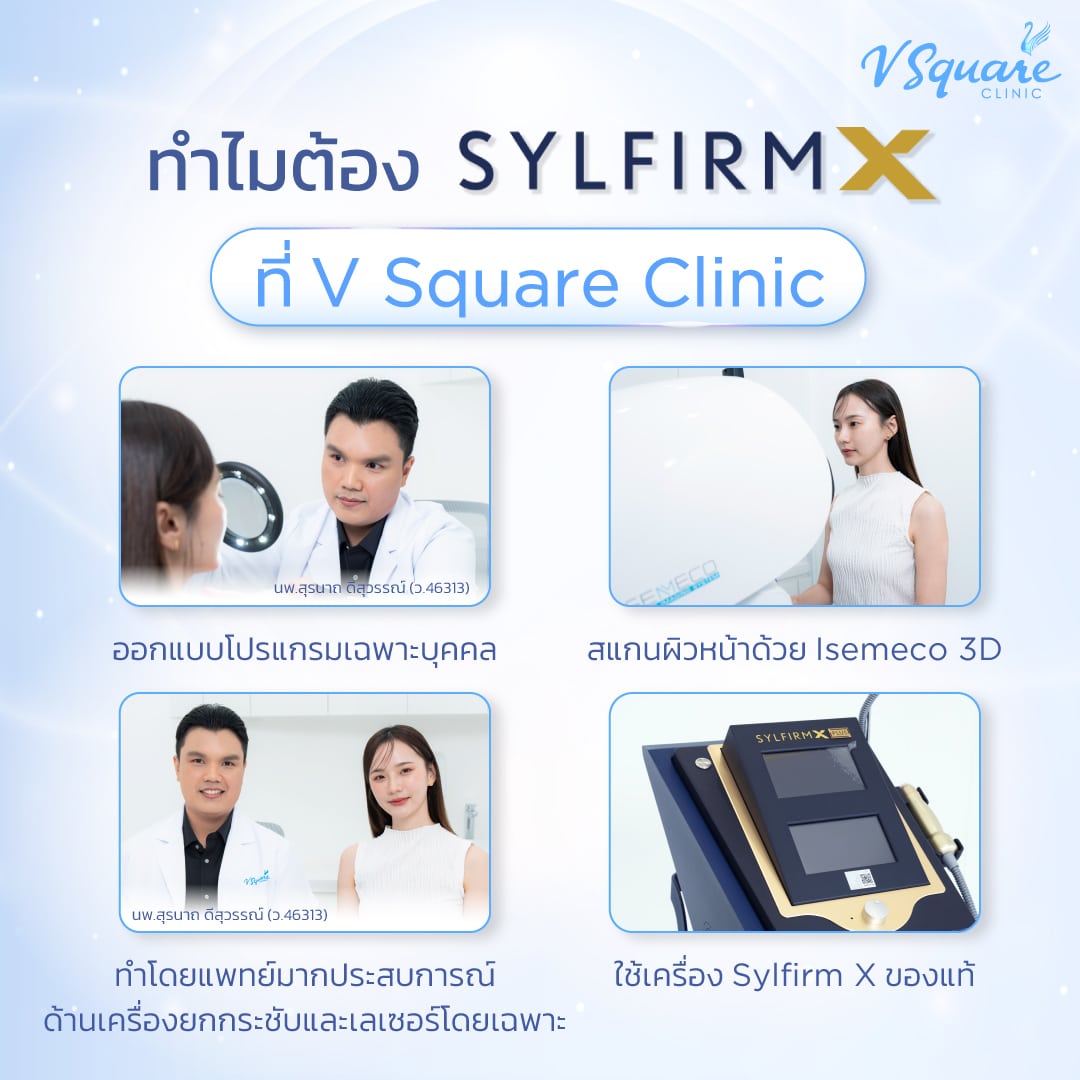 Sylfirm V Square