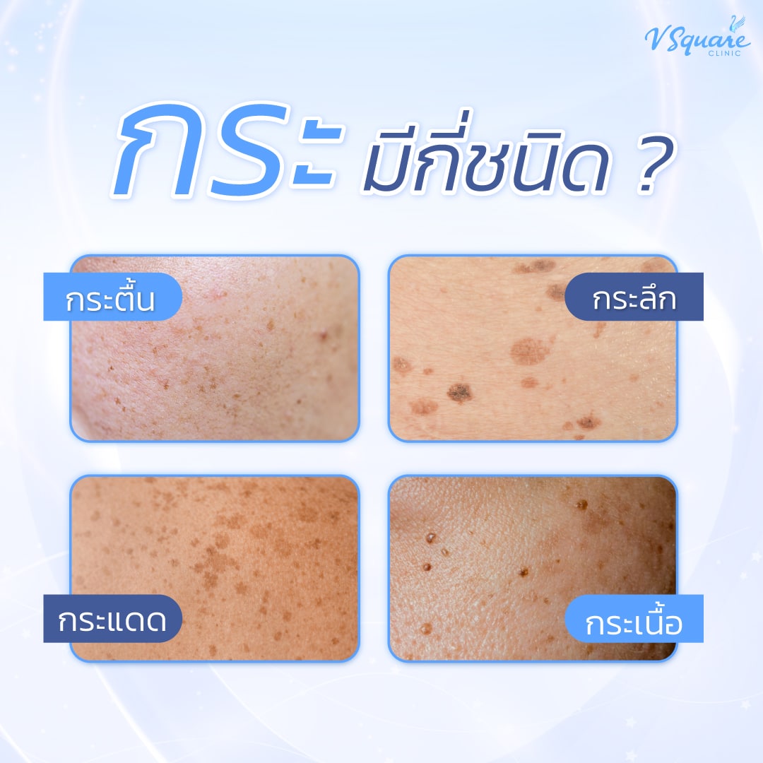 กระมีกี่ชนิด