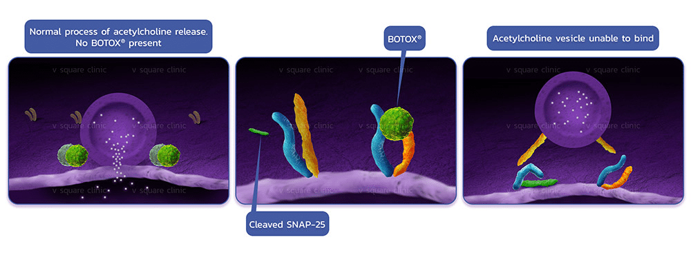 การทำงานของโบท็อกลดริ้วรอย