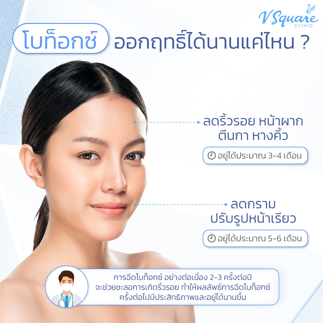 ฉีดโบท็อกลดริ้วรอย อยู่ได้นานเท่าไร