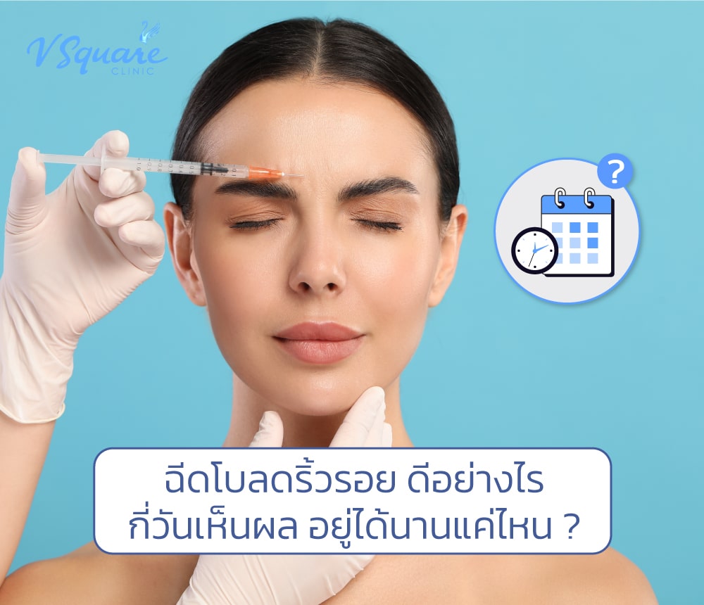 ฉีดโบท็อกลดริ้วรอย