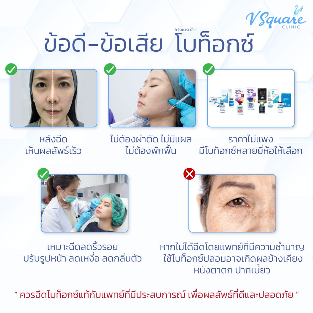 ฉีดโบท็อกลดริ้วรอยคืนความอ่อนเยาว์