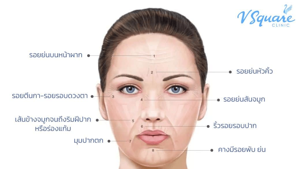 ฉีดโบลดริ้วรอยบนใบหน้า