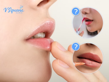 ปากลอก 370x277