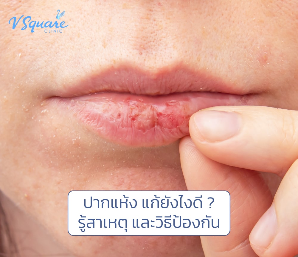 ปากแห้ง