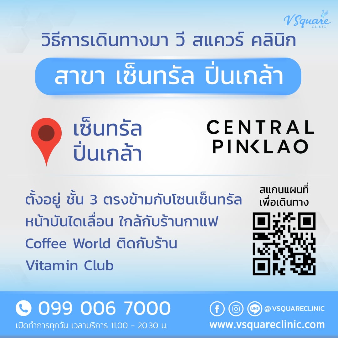 รูปแผนที่สาขาสำหรับต่างชาติเพื่อทีมแชท_เซ็นทรัลปิ่นเกล้า_Vsquareoo_May-29-163107-2025_Conflict-TH