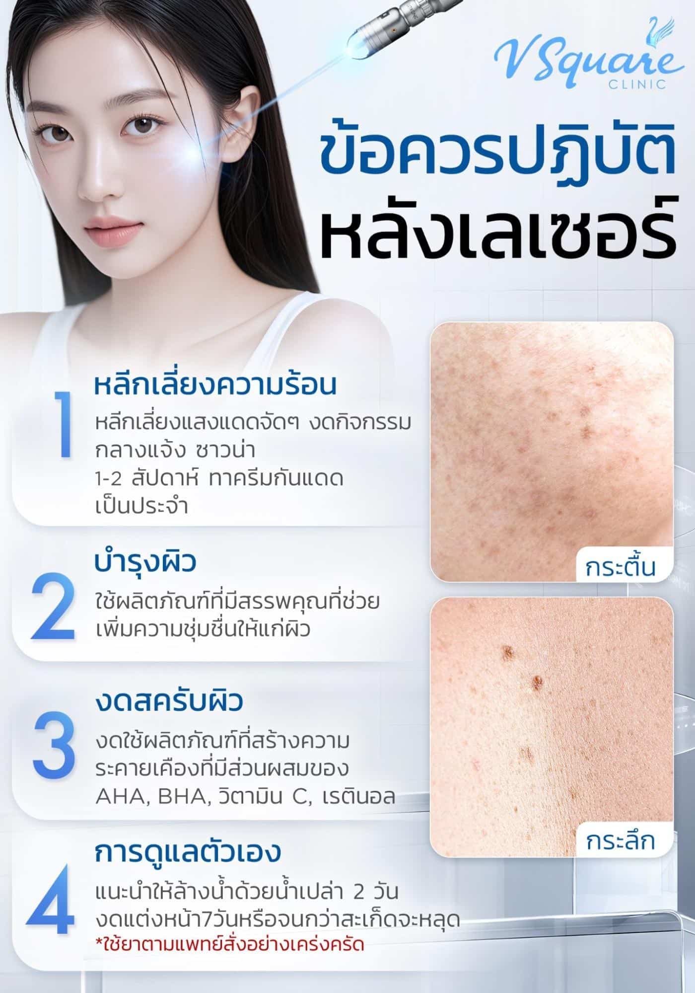 วิธีดูแลหลังเลเซอร์กระ