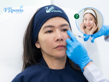 หลังฉีดฟิลเลอร์ ทาครีมได้ไหม 370x277