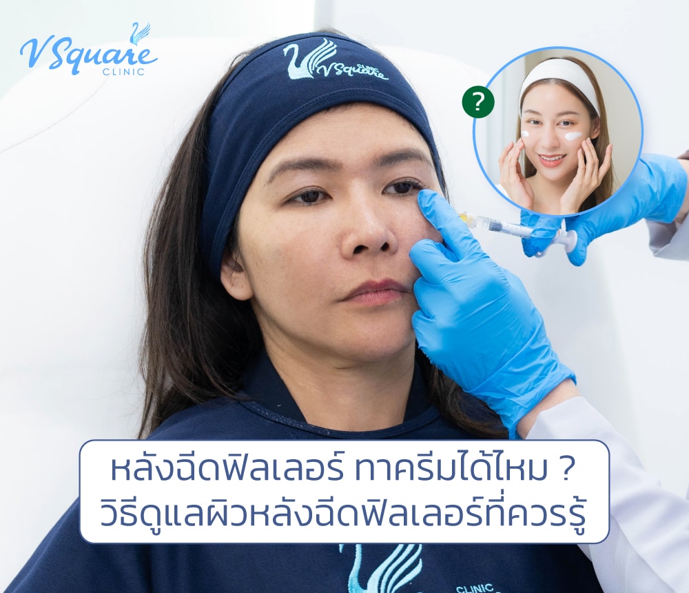 หลังฉีดฟิลเลอร์ ทาครีมได้ไหม