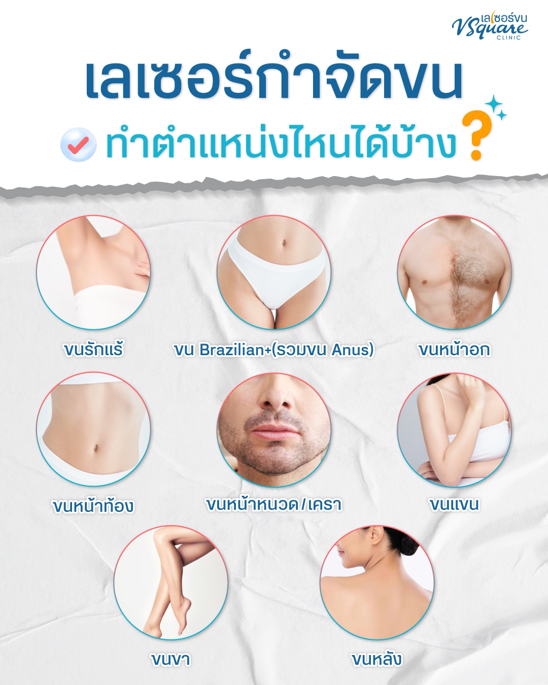 เครื่องเลเซอร์ขน ตำแหน่งไหน