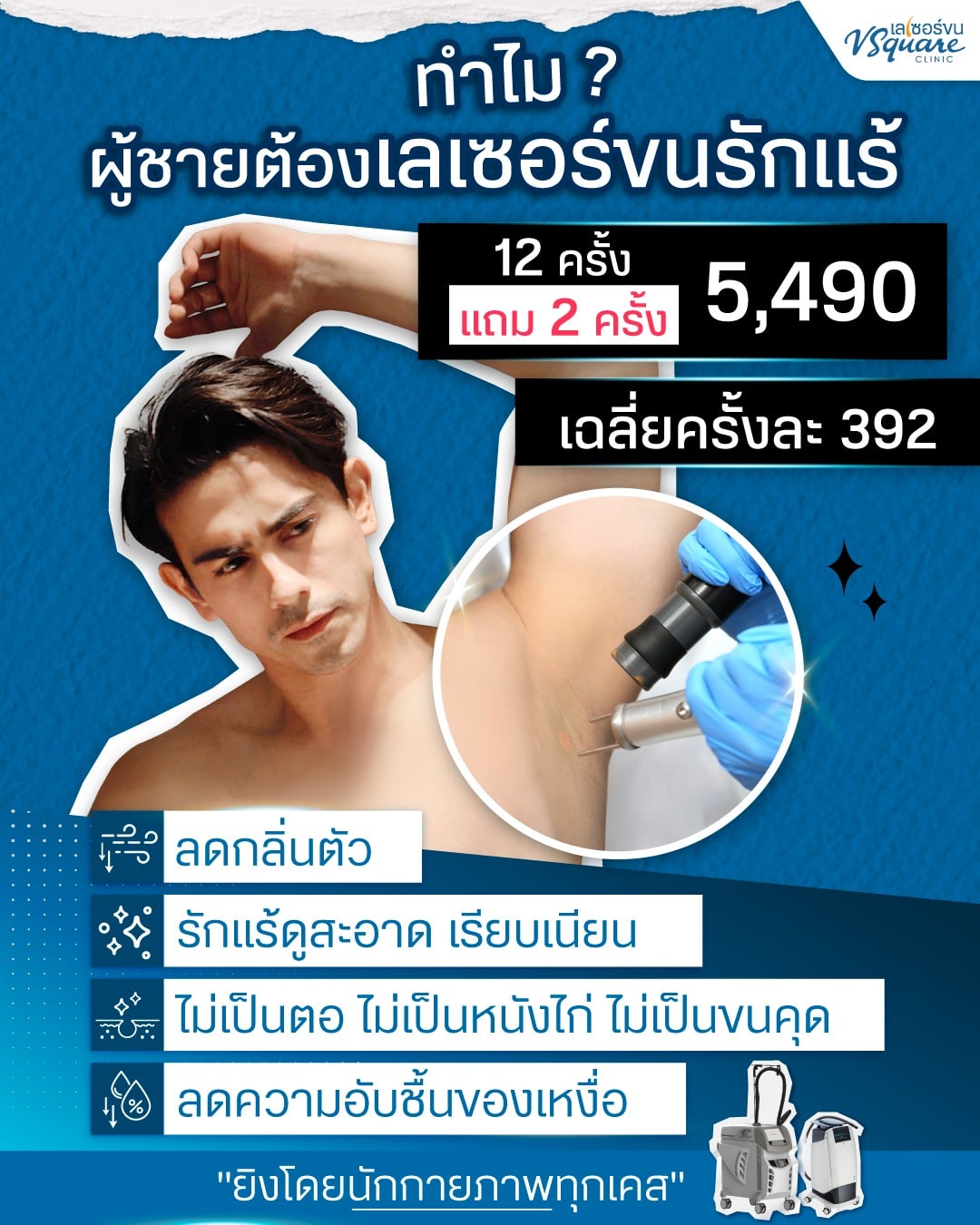 เลเซอร์ขนผู้ชาย ราคา
