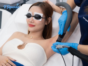 เลเซอร์ขนรักแร้ ราคา 370x277