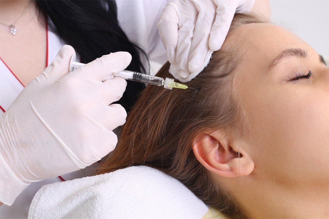 โบท็อกไมเกรน